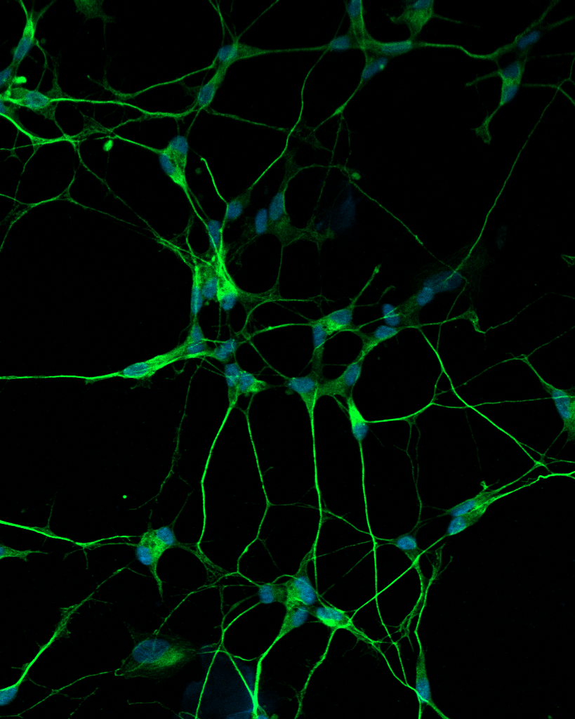 Differentiated_neurons_20x